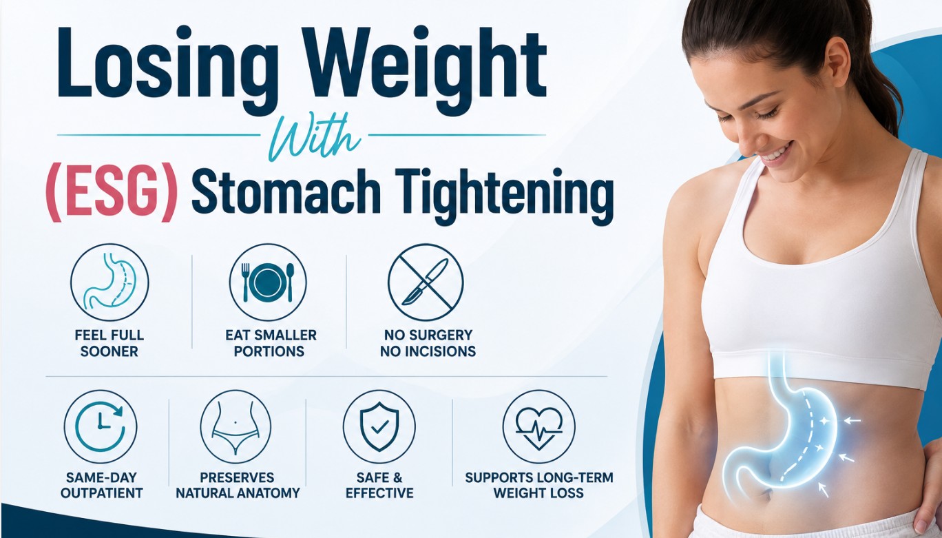 Losing Weight with Endoscopic Sleeve Gastroplasty (ESG) stomach tightening infographic showing the benefits of this minimally invasive weight loss procedure at Khrom MedSpa & Weight Loss.